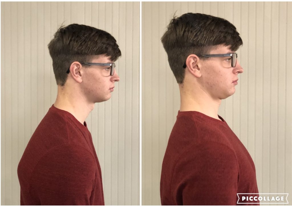 Demonstrates a simple exercise to help restore your natural posture and stop/prevent neck pain and Text Neck. 