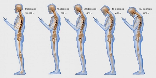 An image of five skeletons demonstrating how much strain is put on the neck depending on the degree of bend. Text Neck occurs from bending your head too far for too long.